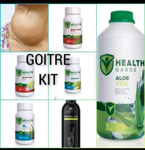 Goiter treatment Goiter treatment